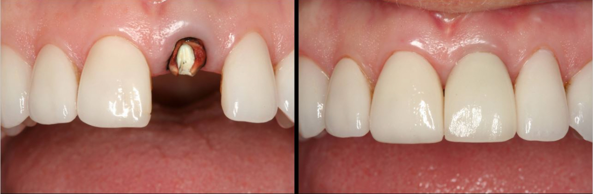 dental-image